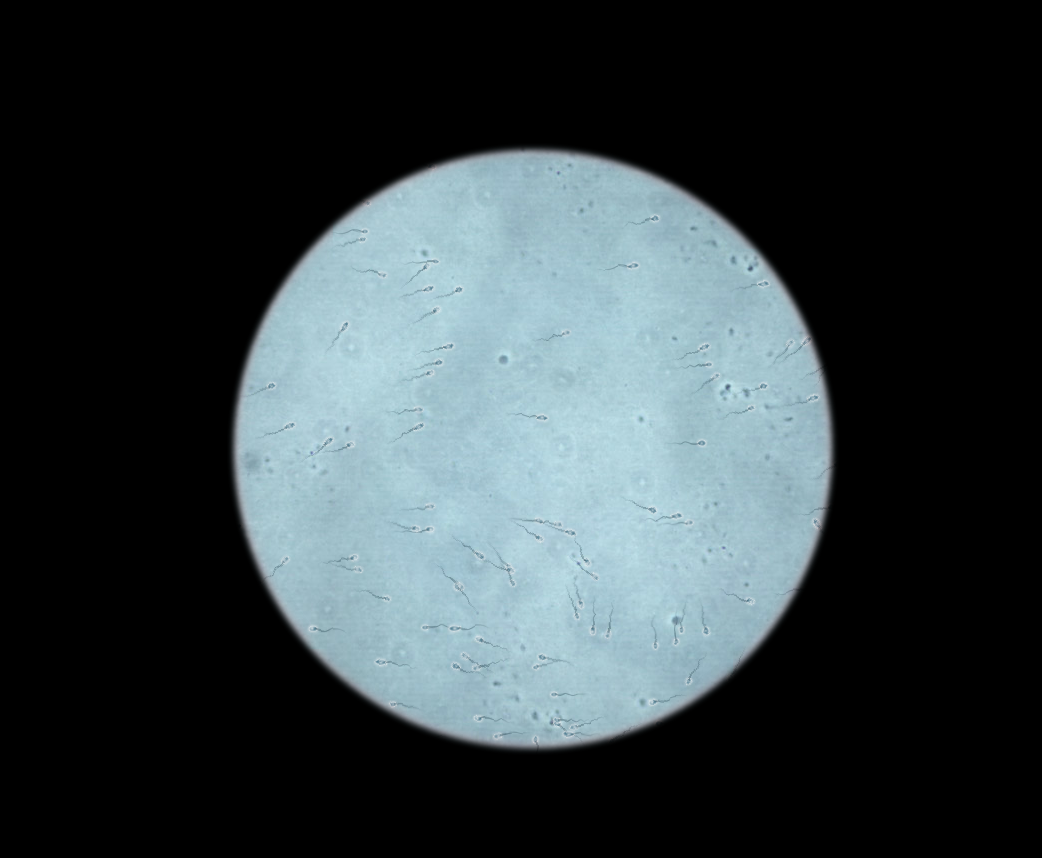 sperm visualizer
